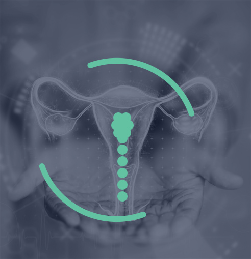 Post-partum hemorrhage management